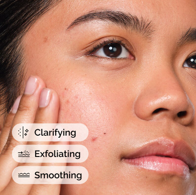 Salicylic Acid 2% Solution (Original)