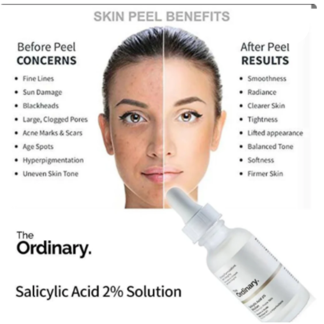 Salicylic Acid 2% Solution (Original)
